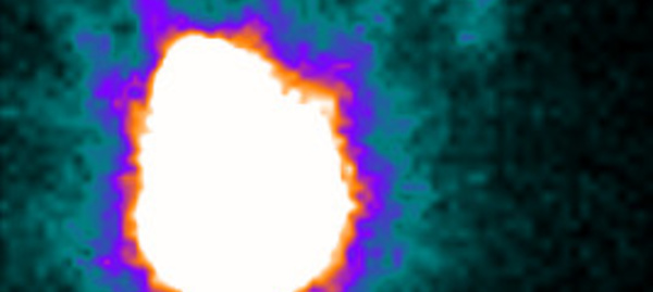 Indications de la recherche du ganglion sentinelle