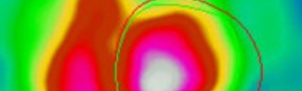 Indications de la FEVG isotopique