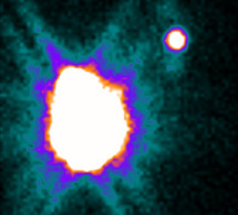 Indications de la recherche du ganglion sentinelle Indications de la recherche du ganglion sentinelle