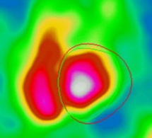Indications de la FEVG isotopique Indications de la FEVG isotopique